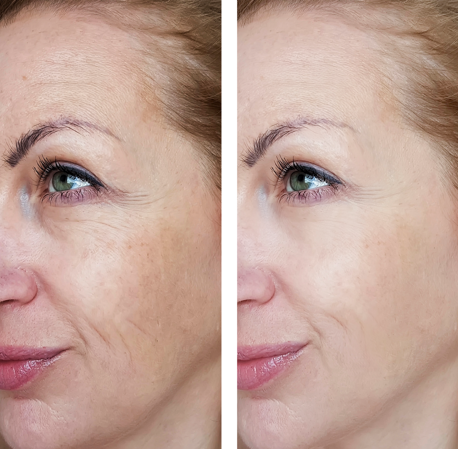 Before Using CPlex and After Using Cplex