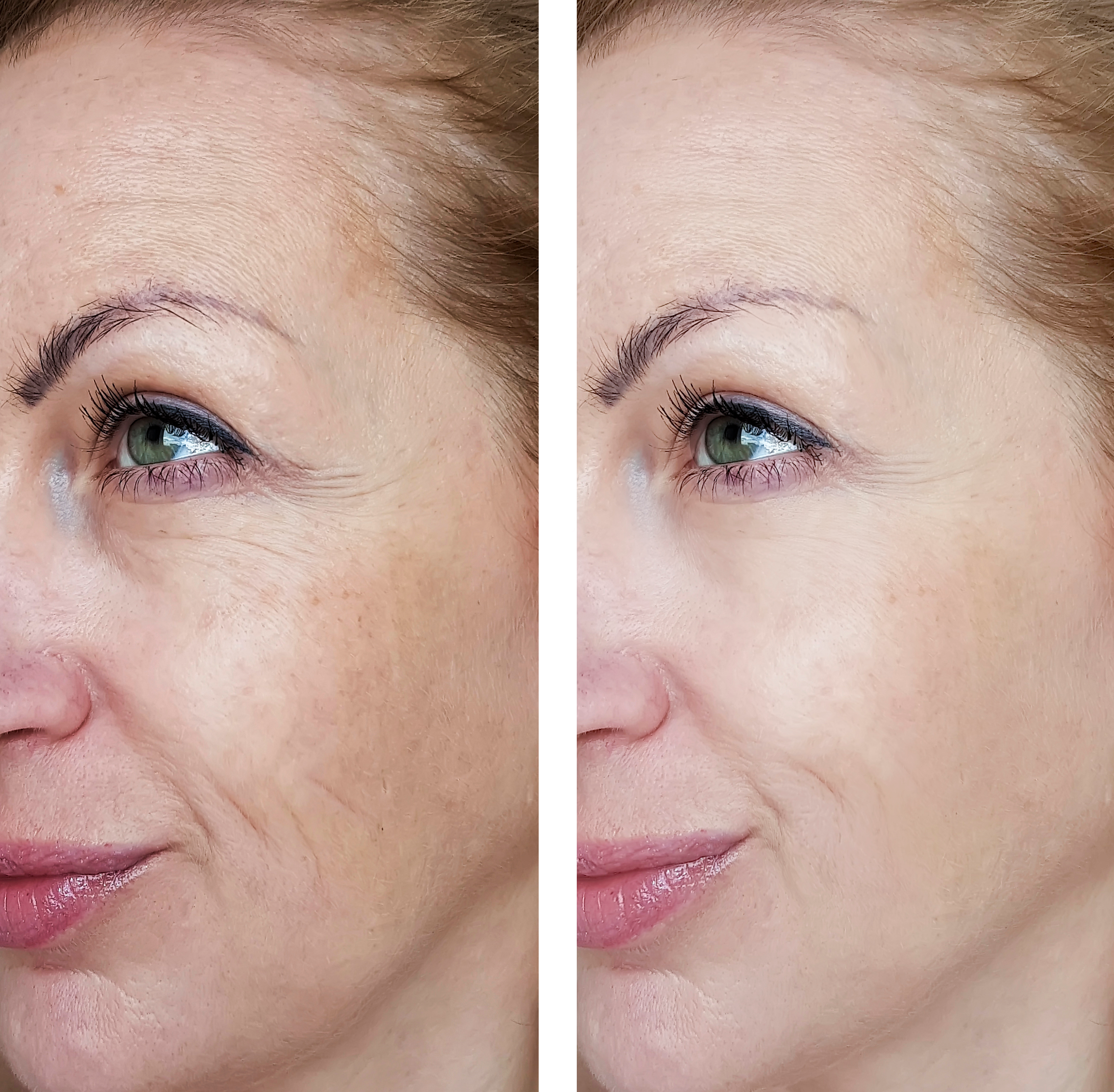 Before Using CPlex and After Using Cplex